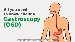 Gastroscopy OGD What is it for and what should I expect [upl. by Ayotas509]