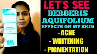 BERBERIS AQUIFOLIUM FOR Fair SKIN  BERBERIS AQUIFOLIUM HOMEOPATHIC FOR WHITENING amp GLOWING SKIN [upl. by Ettenaej293]