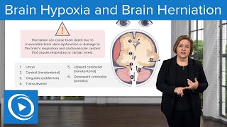 Brain Hypoxia and Brain Herniation – MedSurg Nursing  Lecturio [upl. by Aidyn]