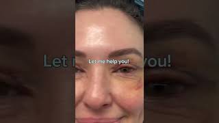 THINKING ABOUT GETTING PLASTIC SURGERY  DR TANVEER JANJUA  NEW JERSEY [upl. by Nadabb]