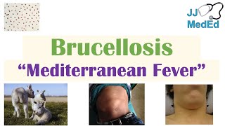 Brucellosis Mediterranean Fever  Transmission Pathogenesis Symptoms Diagnosis Treatment [upl. by Meid481]