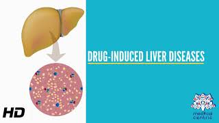 DrugInduced Liver Disease Causes Signs and Symptoms Diagnosis and Treatment [upl. by Koosis]