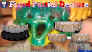 Dental Lab Work  Ceramic Teeth  Fixed Partial Denture  All Stage Short Video  Tamil Dental Lab 🦷 [upl. by Kim]