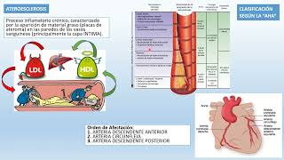 ❤❤Resumen completo de CARDIOPATIA ISQUÉMICA  ANGINA  INFARTO AGUDO MIOCARDIO IAM [upl. by Leone]