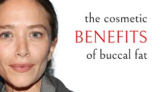 Cosmetic benefits of keeping buccal fat  Perioral Mounds  Jowls  Facial Sculpting with Dr Zelken [upl. by Terra331]