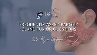 Parotid Gland Tumors Frequently Asked Questions by Dr Ryan Osborne [upl. by Porta165]