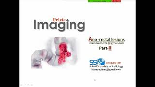 23 Imaging of rectal cancer II Prof Mamdouh Mahfouz [upl. by Ivatts135]