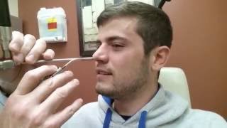 Septoplasty  Nasal Splint Removal  Post Surgery [upl. by Skoorb]