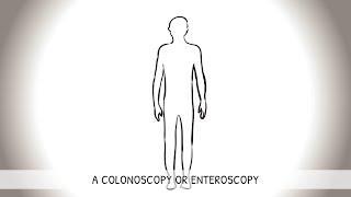 Koloskopie Innere Medizin [upl. by Nivi]