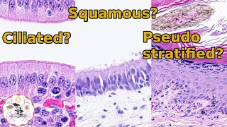 Surface Epithelium  Identifying Different Types [upl. by Cross]