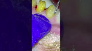 Filing Down 6 Teeth For Cosmetic Crowns [upl. by Lika]