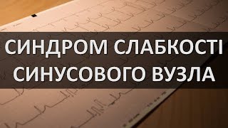 СИНДРОМ СЛАБКОСТІ СИНУСОВОГО ВУЗЛА ЕКГ ОЗНАКИ [upl. by Petite]