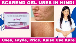 Scarend Gel Uses in Hindi  Allium Cepa Extract Heparin Sodium Allantoin Gel  Kaise Use Kare [upl. by Adneram981]