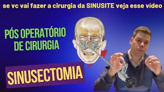 PÓS OPERATÓRIO DA CIRURGIA DE SINUSITE SINUSECTOMIA [upl. by Nyrehtak]