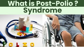 Post Polio Syndrome  Causes Symptoms and Treatment [upl. by Zetnauq]