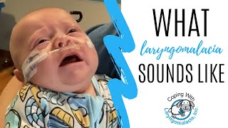 What Laryngomalacia Sounds Like  noisy breathing  newborn congestion [upl. by Htedirem]