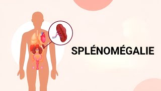 SÉMIOHÉMATO🩸 SPLÉNOMÉGALIE  3ÈME MÉDECINE ✅✅ Unité4👅🩸 [upl. by Orford]