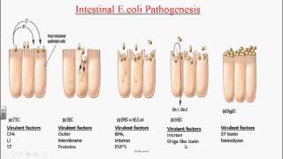 Enterobacteriaceae  Escherichia coli  Klebsiella pneumoniaemp4 [upl. by Thurlow]