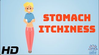 SOS Stomach Itchiness Survival Guide [upl. by Sylvanus]