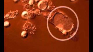 Time lapse video of the Chlamydia trachomatis developmental cycle [upl. by Aivat]