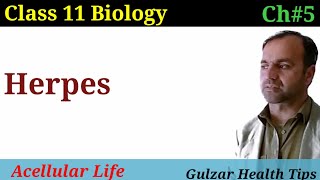 Herpes  CausesTypesSymptomsTreatment and prevention of Herpes  class 11 biology [upl. by Yarased]