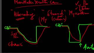 MuniHealth  144 What Is Hibernating amp Stunned Myocardium [upl. by Neumark]