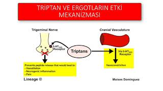 MİGREN TEDAVİSİ [upl. by Glaab]