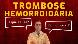 Trombose Hemorroidária Causas e Tratamento Dr Fernando Lemos  Planeta Intestino [upl. by Rickert]