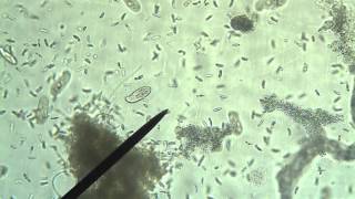 Protists Amoeba Euglena Paramecium [upl. by Lezned]