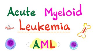 Acute Myeloid Leukemia AML  Auer Rods  Myeloperoxidase Positive  Hematology amp Oncology Series [upl. by Gnok]