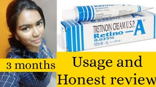 Retin A 0025cream Review Before And After Tretinoin Cream ReviewMy experience with Tretinoin [upl. by Ahpla]