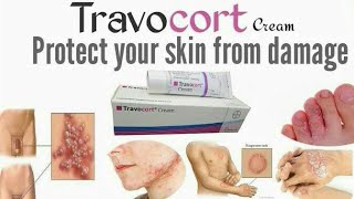 Travocort Isoconazole Nitrate and Diflucortolone Valerate cream for RednessinflamationNappy Rash [upl. by Salomi]