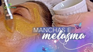 DERMAMELAN O PEELING QUE TRATA MANCHAS E MELASMA l Dra Cintia Cunha [upl. by Aromas]