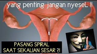 PASANG IUD SPIRAL SAAT OPERASI SESAR  JANGAN NYESAL [upl. by Lenzi]