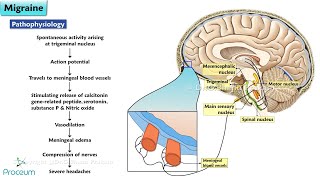 Migraine Medication Animation 🧠 Drug Classes Mechanisms of Action and New Treatments [upl. by Yssak]