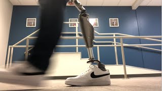 Hip disarticulation prosthetic gait demonstration 2022 [upl. by Jaclin543]