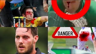 Top 7 Killer Bouncer on Face by Shoaib Akhtar Batsmen gets Injured [upl. by Atilrak991]