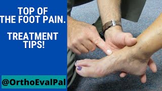 Top of the foot pain Treatment tips [upl. by Kissner305]