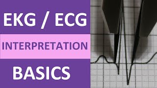 EKGECG Interpretation Basics Nursing NCLEX  QRS Complex P Wave T Wave PR Interval [upl. by Tompkins831]