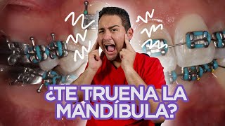 😖 ”ME TRUENA LA MANDÍBULA” 😖 ¡DEBERÍAS VER ESTE VIDEO😍 🔥CASO de CHASQUIDOS RESUELTO en 2021🔥 [upl. by Onabru]