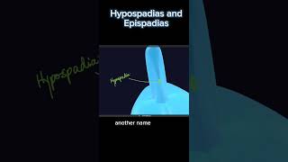 Hypospadias and Epispadias Complete course link available in comment [upl. by Singleton]