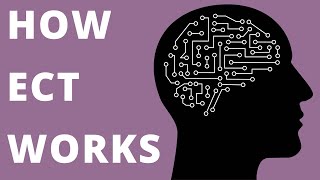 How ECT Works electroconvulsive therapy [upl. by Ytirehc120]