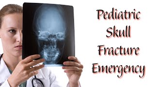 Skull Fracture Emergency in a 4YearOld Boy [upl. by Lusa]