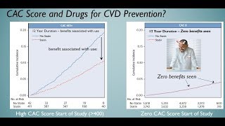 Coronary Calcification  and Fixing the Root Causes of Heart Disease LCHF CAC CVD [upl. by Knowle]