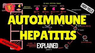 AUTOIMMUNE HEPATITIS Pathogenesis Clinical symptoms Diagnostic criteria Treatment [upl. by Witte]