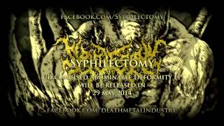 SYPHILECTOMY  Abnormality Through Purulent Sputum Official Video Stream [upl. by Proctor]