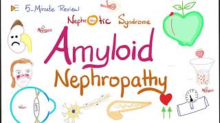 Amyloid Nephropathy  Kidney Pathology Lectures [upl. by Ilellan840]