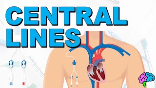 The Basics of Central Lines  Central Venous Catheters CVC [upl. by Eekram]