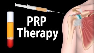 PRP Therapy Animation [upl. by Ariad]