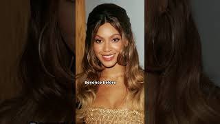 Celebrities Who Looked Different Before Plastic Surgery [upl. by Kenison]